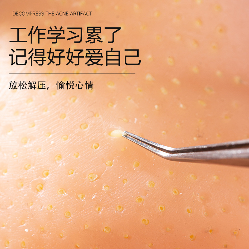 Stress relief, pimple squeeze, - Dolls review and price